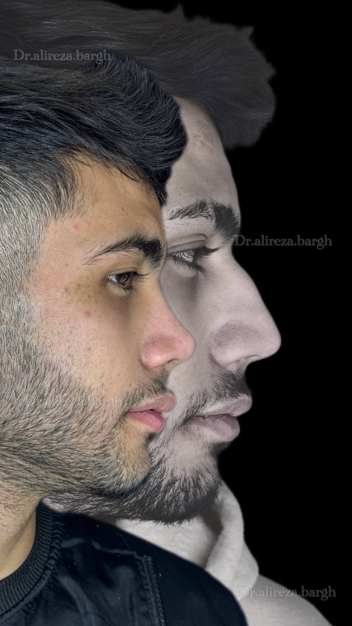 نمونه کار جراحی 
