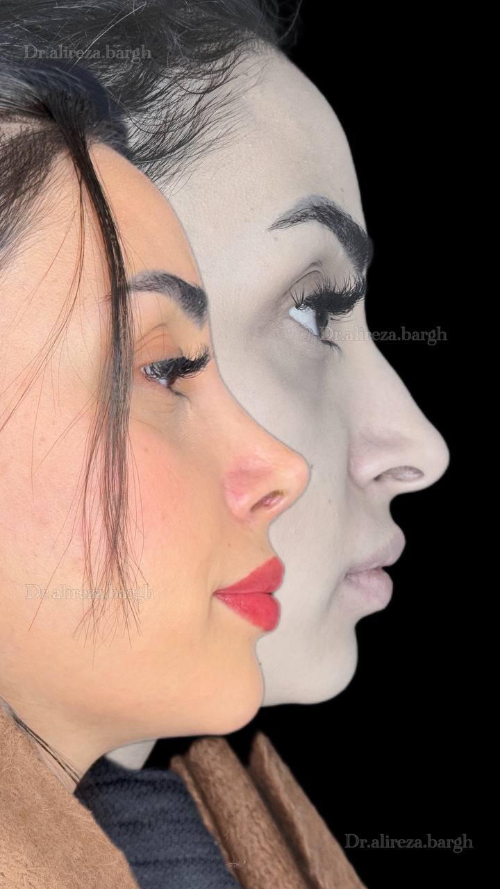 نمونه کار جراحی 