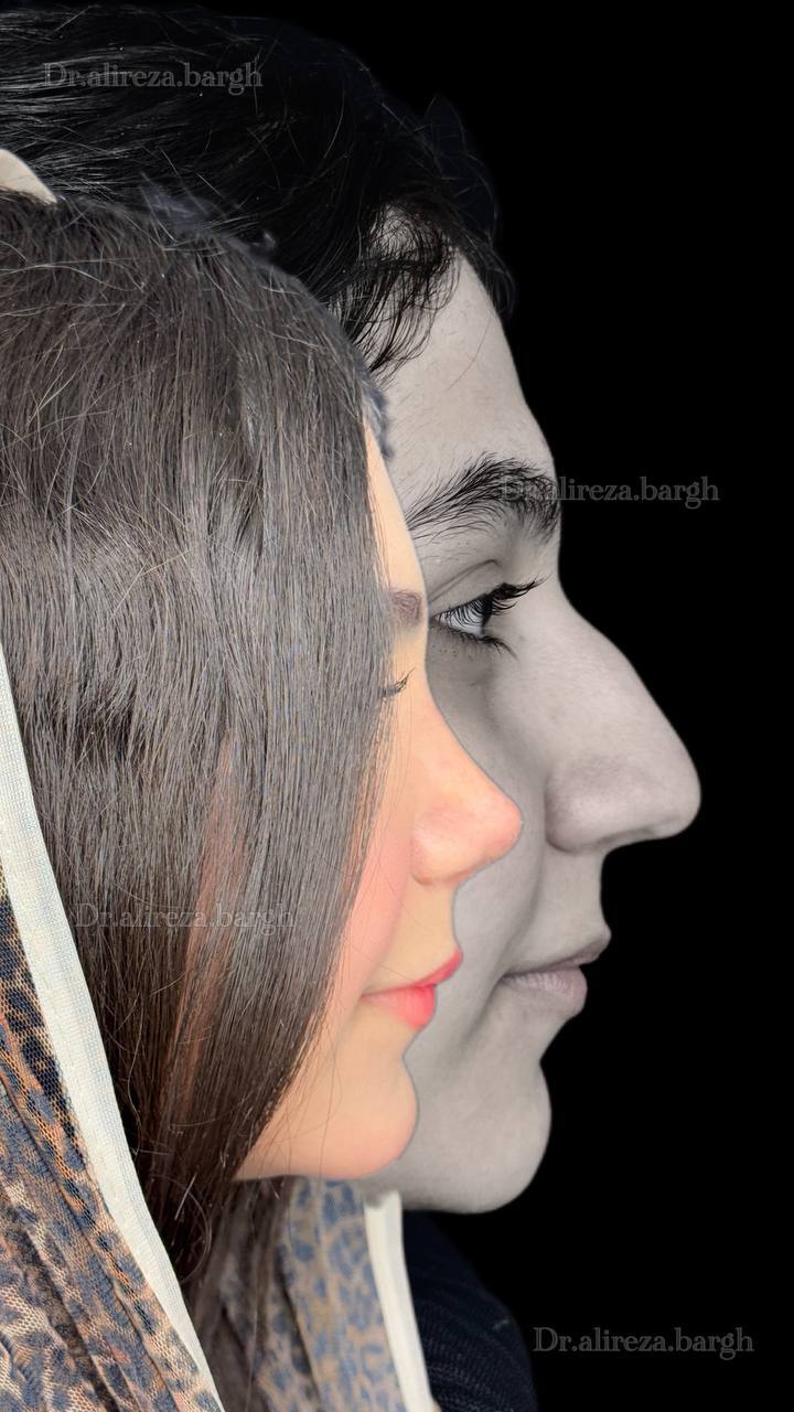 نمونه کار جراحی 