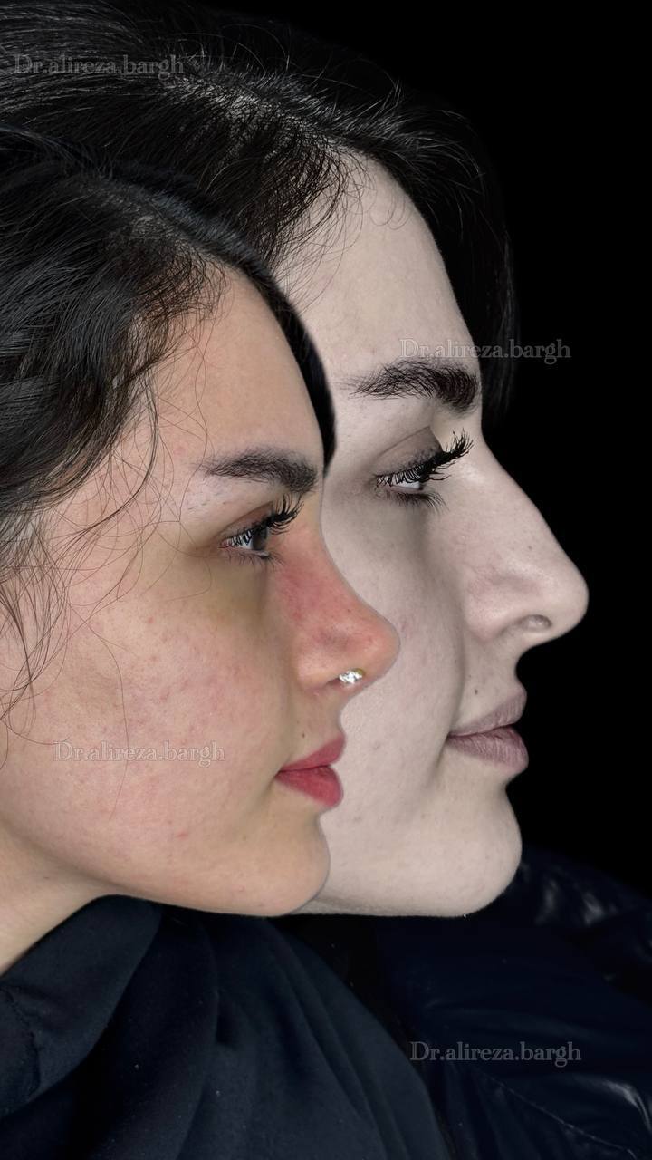 نمونه کار جراحی 