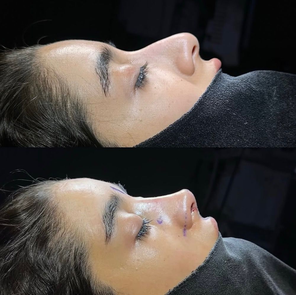 نمونه کار جراحی 